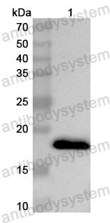 Валидация AntibodySystem PHB81601
