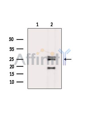 Валидация Affinity DF15107 - 11352