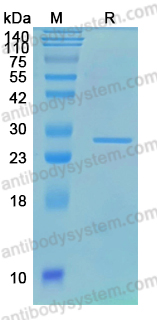 YVV45401, SDS-PAGE