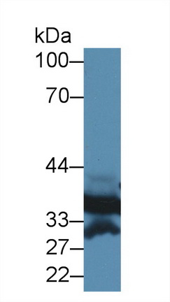 14146