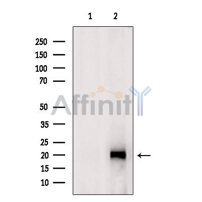Валидация Affinity DF3802 - 14918