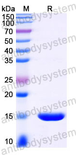 Валидация SDS-PAGE - AntibodySystem RZZ03502