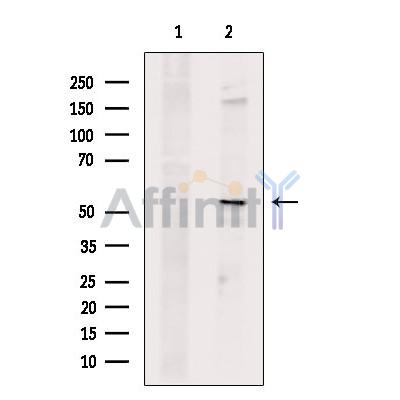 Валидация Affinity DF10084 - 5572