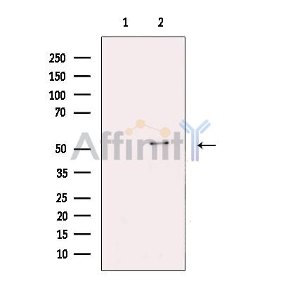 Валидация Affinity AF5284 - 2816