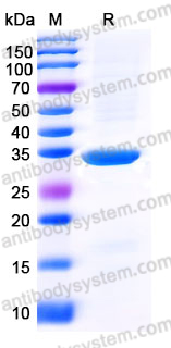 EHE28201, SDS-PAGE