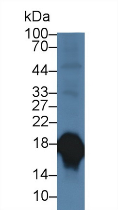 14016