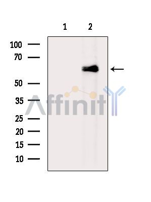 Валидация Affinity DF15006 - 11213