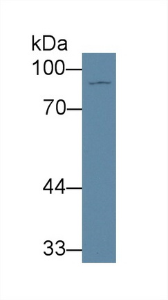 12779