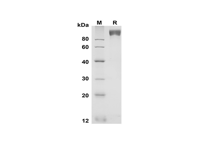 Валидация Elabscience PDMM100180(1140)