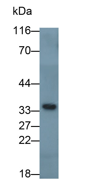 30951