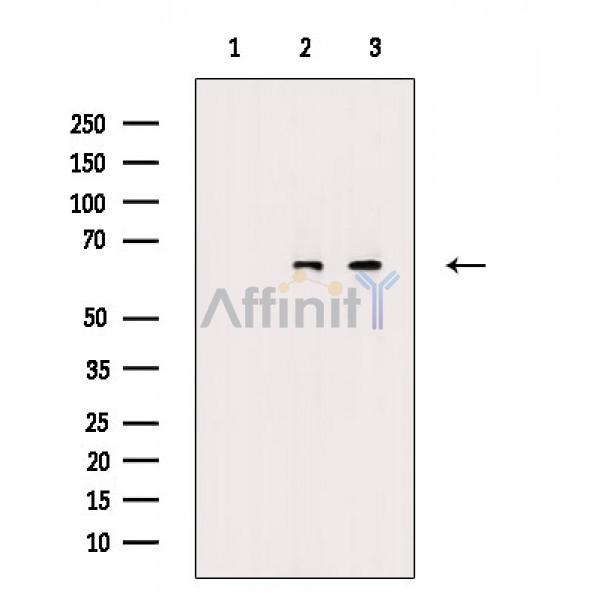 Валидация Affinity DF7078 - 18720