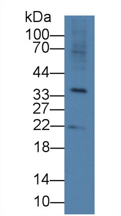 9451