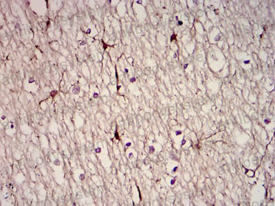 Валидация AntibodySystem RHD03106