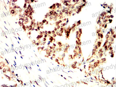 Валидация AntibodySystem RHF89601
