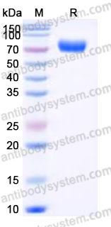 EHJ76302, SDS-PAGE