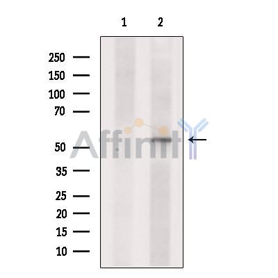 Валидация Affinity DF7145 - 18796