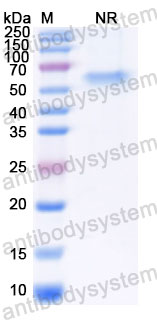 Валидация SDS-PAGE - AntibodySystem RHK81501