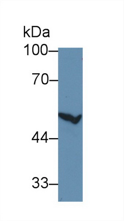 14915