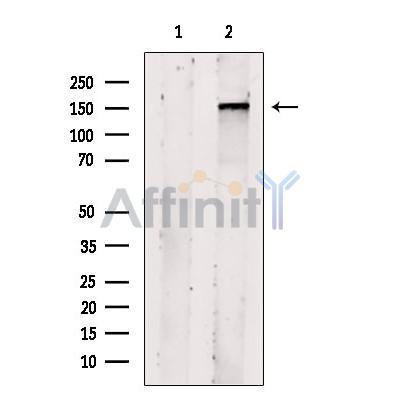 Валидация Affinity DF12056 - 6111