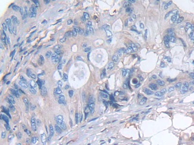 17004