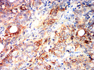 Валидация AntibodySystem RHK08804 (3619)