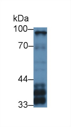 12762