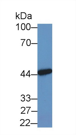 14189