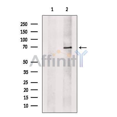 Валидация Affinity DF13638 - 9183