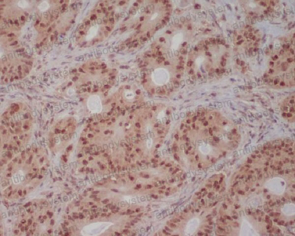 Валидация AntibodySystem RHA12301