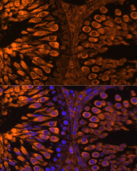 A15003, иммунофлуоресценция, срезы семенников крысы (11828)
