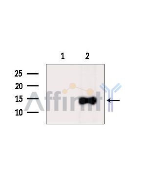 Валидация Affinity DF15119 - 11366
