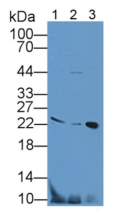 12015