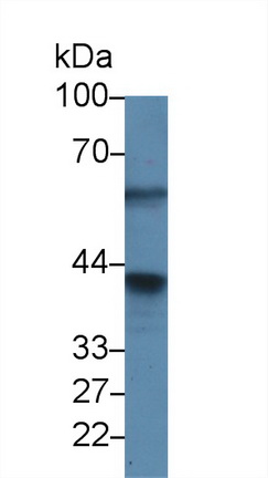 12594