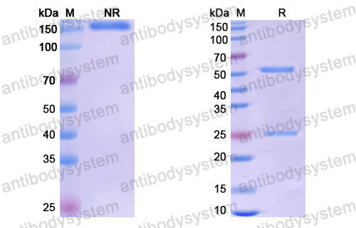 Валидация SDS-PAGE - AntibodySystem DHD85405