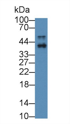 12861