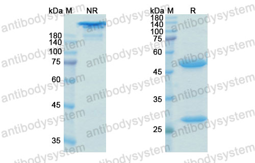 Валидация SDS-PAGE - AntibodySystem DHD46602
