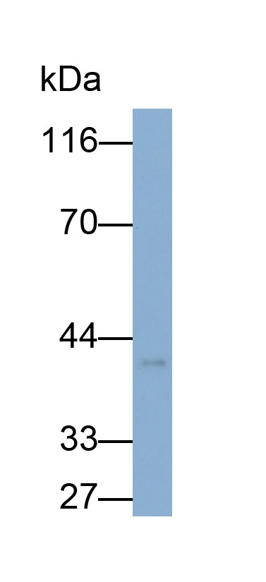 32538