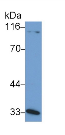 11047