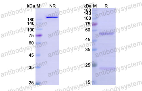 Валидация SDS-PAGE - AntibodySystem DHD68904