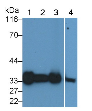 14887