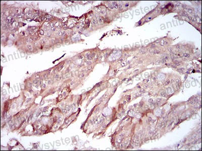 Валидация AntibodySystem RHD73102 (1762)