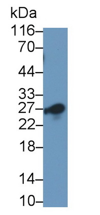 56359
