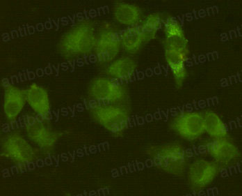 Валидация IF - AntibodySystem RHD57905