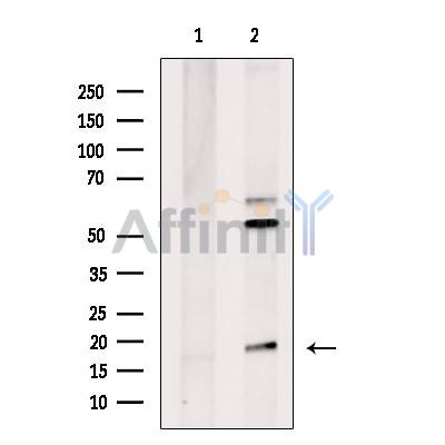 Валидация Affinity DF9134 - 21461