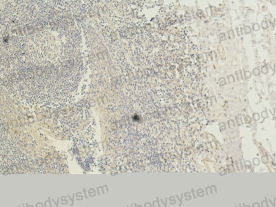 Валидация AntibodySystem RHC18706