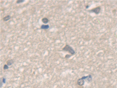 17413