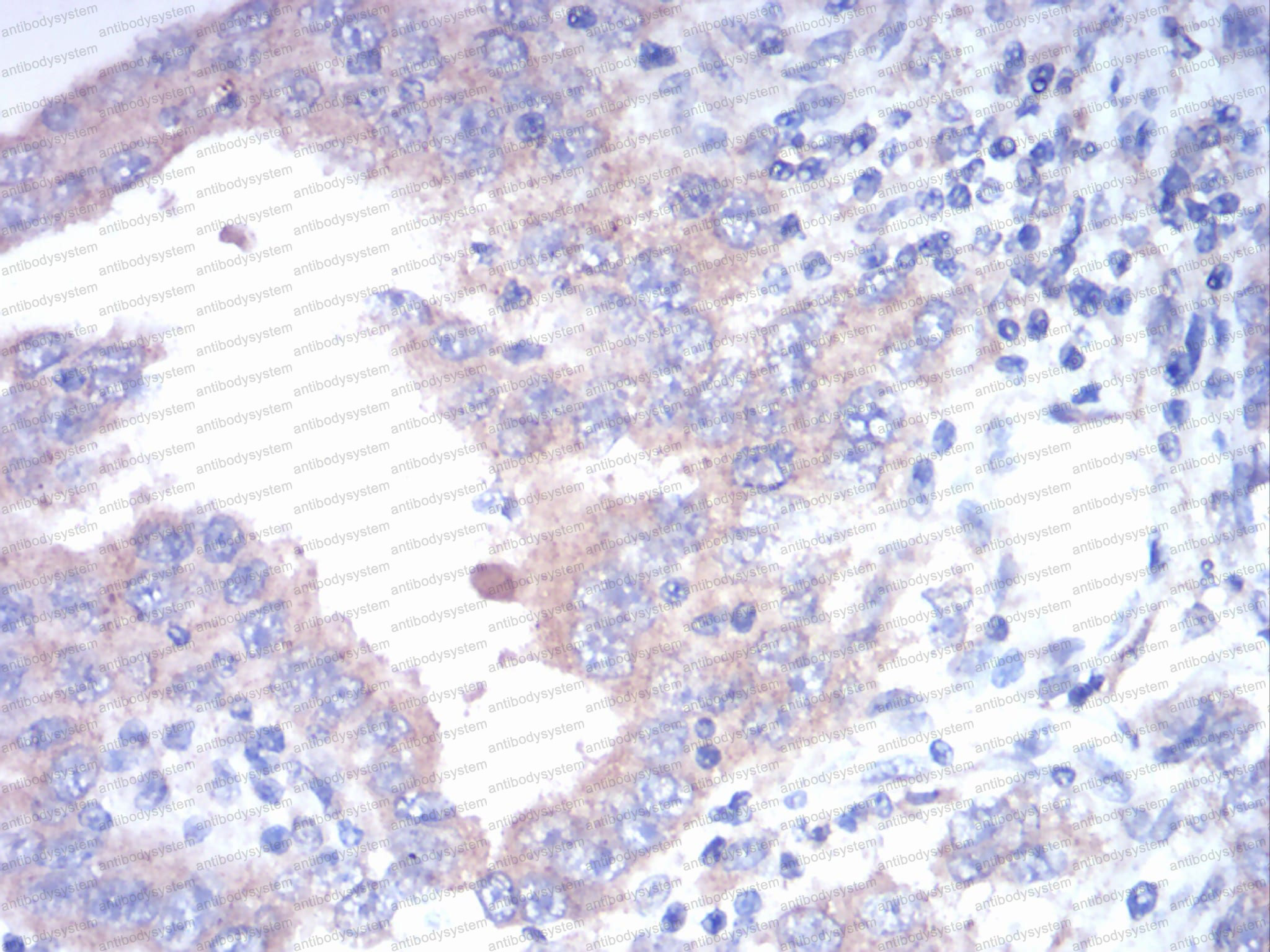 Валидация AntibodySystem RHD52903