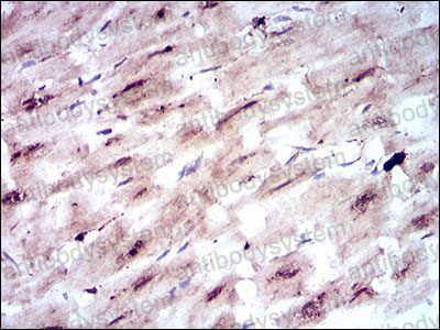 Валидация AntibodySystem RHD06202
