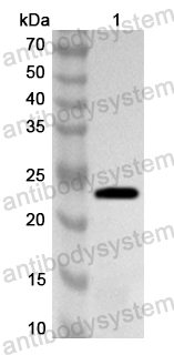 Валидация AntibodySystem PXX20401