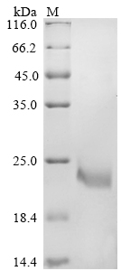 SDS-PAGE